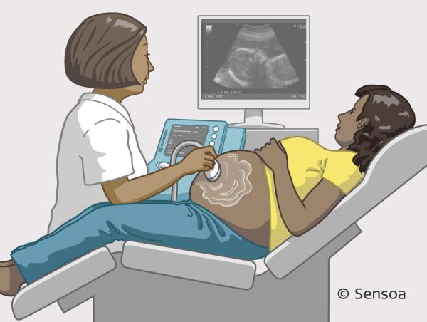 Gynaecoloog maakt een echografie.